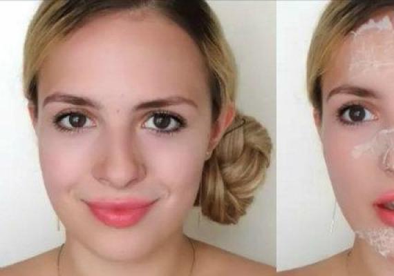 Как очистить лицо от черных точек: поход к косметологу и рецепты масок для домашних процедур