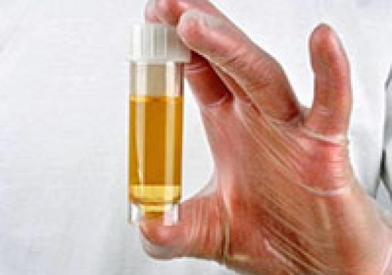 Miks on uriinil tugev lõhn?